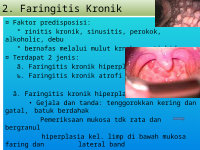 Faringitis cuanto tiempo dura